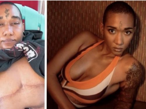 Diana King chops off her breasts; singer Brian Hart says “hope they didn’t go to waste…nuff hungry dog deh a road”